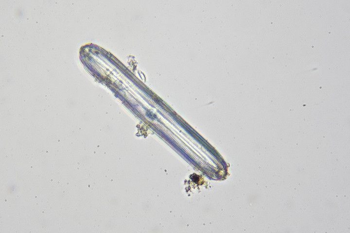Pinnularia frustule - the silica skelton of diatom pinnularia